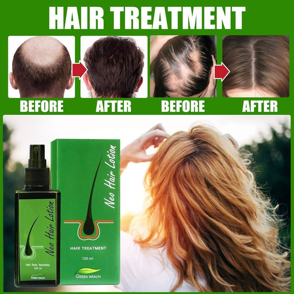 NEO Hair Regrowth Lotion 120ml Anti-Hair Loss Spray